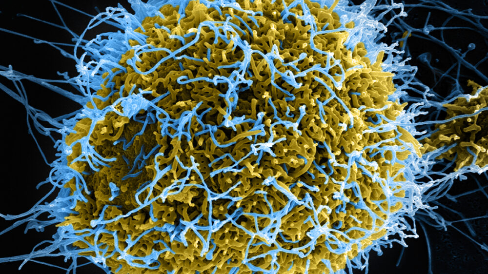 Китайские ученые создали в лаборатории суррогатный вирус, способный убивать за два дня
