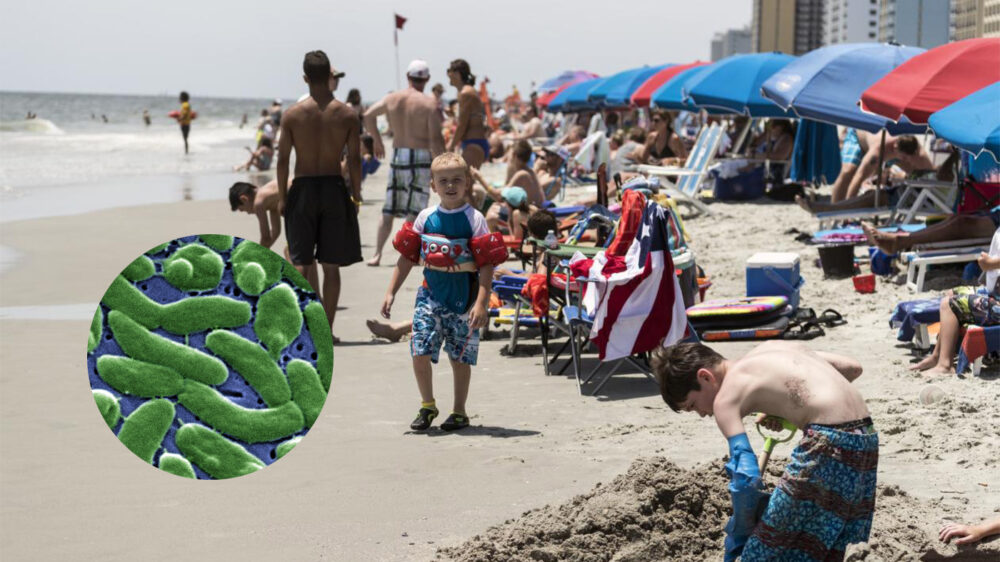 Житель Южной Каролины подцепил «пожирающие» плоть бактерии на пляже. Что нужно знать о вибриозе?
